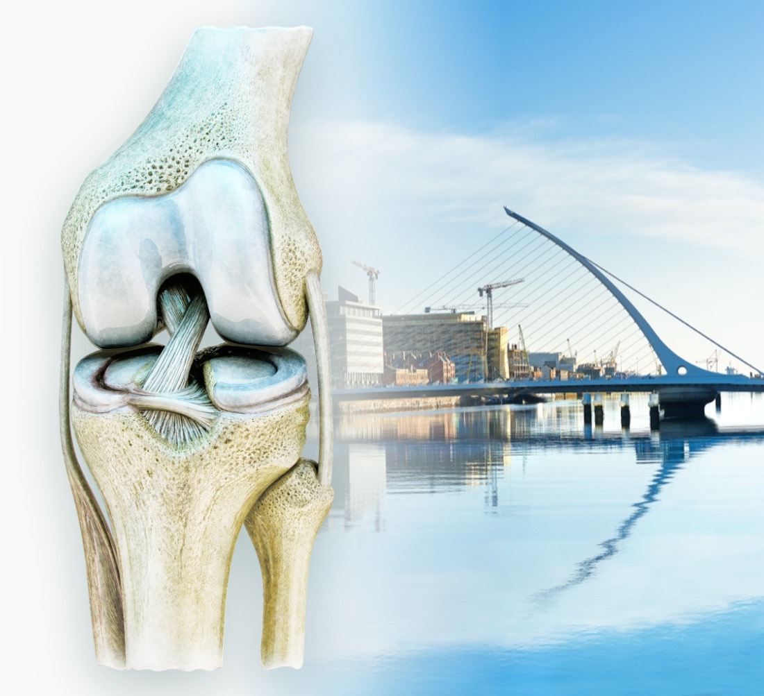 A knee joint showing the anterior cruciate ligament, beside the Samuel Beckett Bridge in Dublin